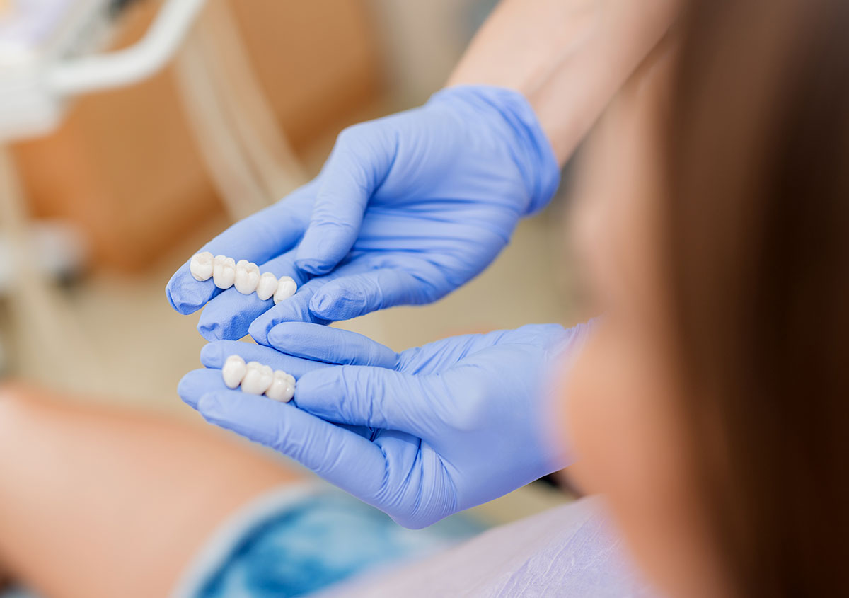 Nurse showing dental bridges - Dentist in West Chester PA