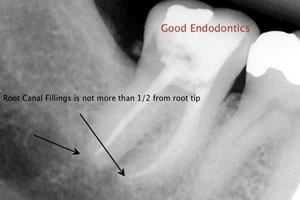 Root Xray
