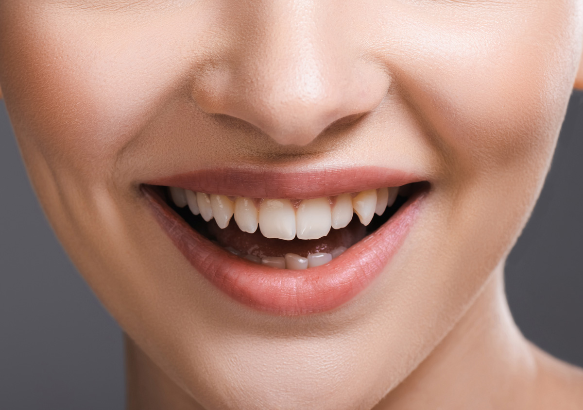 Chipped Tooth Repair and How A Cosmetic Dentist Can Help - Cheadle