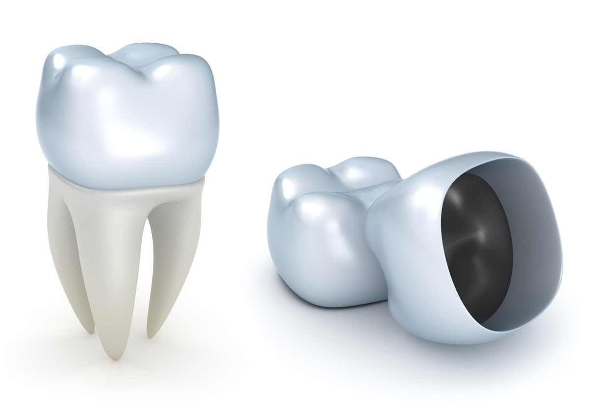 Restore Smile With Dental Crowns for Tooth West Chester